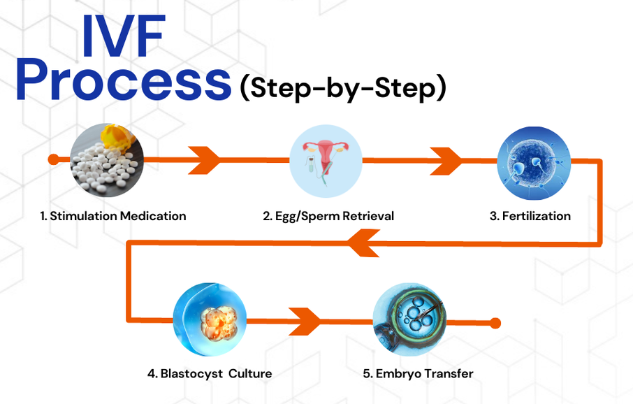 IVF Step by Step